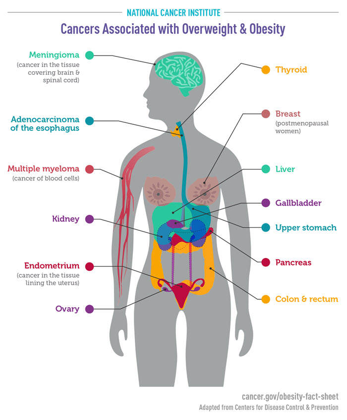 The 13 Cancer identifified by the NIH connected to Obesity